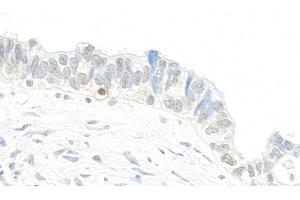 anti-Topoisomerase (DNA) II beta 180kDa (TOP2B) (AA 1475-1525) antibody