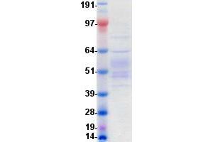 Validation with Western Blot