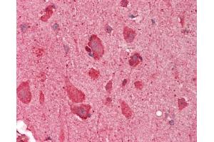 Immunohistochemistry (Paraffin-embedded Sections) (IHC (p)) image for anti-Solute Carrier Family 17 (Acidic Sugar Transporter), Member 5 (SLC17A5) (AA 151-200) antibody (ABIN6756564)