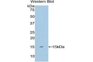 Detection of Recombinant KRT2, Human using Polyclonal Antibody to Keratin 2 (CK2) (Keratin 2 antibody  (AA 7-160))