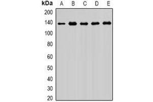 Western blot analysis of Exportin 5 expression in MCF7 (A), HIH3T3 (B), PC12 (C), mouse brain (D), rat brain (E) whole cell lysates. (XPO5 antibody)