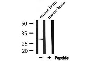 Western blot analysis of extracts from mouse brain, using RAB7L1 Antibody. (RAB7L1 antibody  (Internal Region))