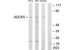 Western blot analysis of extracts from HeLa/293/HuvEc cells, using ADCK5 Antibody.