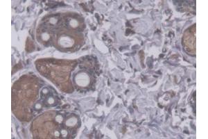 DAB staining on IHC-P; Samples: Rat Skin Tissue (RHAG antibody  (AA 251-450))