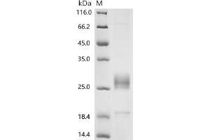 Fibroblast Growth Factor 7 (FGF7) (AA 32-194), (full length) protein (His tag)