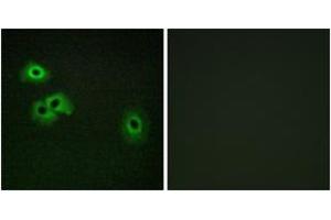 Immunofluorescence analysis of HepG2 cells, using Calmodulin (Phospho-Thr79+Ser81) Antibody.