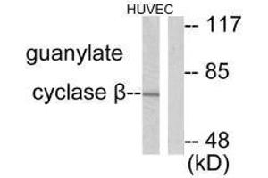 Western blot analysis of extracts from HuvEc cells, using Guanylate Cyclase β antibody. (GUCY1B3 antibody)