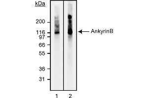 Western Blotting (WB) image for anti-Ankyrin 2, Neuronal (ANK2) antibody (ABIN967633) (ANK2 antibody)