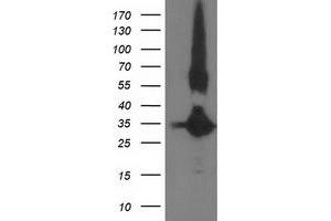 HEK293T cells were transfected with the pCMV6-ENTRY control (Left lane) or pCMV6-ENTRY MGLL (Right lane) cDNA for 48 hrs and lysed. (MGLL antibody)