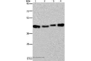 Western blot analysis of HepG2, Raji, A431 and 231 cell, using DNAJA1 Polyclonal Antibody at dilution of 1:800 (HSP40-4 antibody)