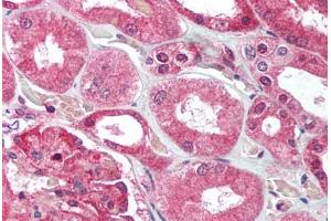 Human Kidney (formalin-fixed, paraffin-embedded) stained with UBE2N antibody ABIN214016 at 2. (UBE2N antibody  (C-Term))