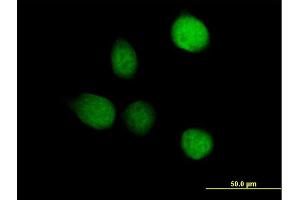 Immunofluorescence of purified MaxPab antibody to TSEN2 on HeLa cell. (TSEN2 antibody  (AA 1-465))