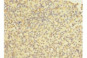 Immunohistochemistry of paraffin-embedded human spleen tissue using ABIN7170685 at dilution of 1:100 (Stabilin 2 (STAB2) (AA 1550-1850) antibody)