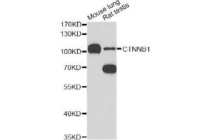 Western blot analysis of extracts of various cell lines, using CTNNB1 antibody (ABIN5997534) at 1/1000 dilution. (CTNNB1 antibody)