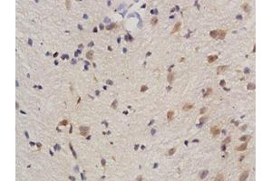Formalin-fixed and paraffin embedded rat brain tissue labeled with Anti phospho-REC8(Ser251) Polyclonal Antibody, Unconjugated  followed by conjugation to the secondary antibody and DAB staining (REC8 antibody  (pSer251))