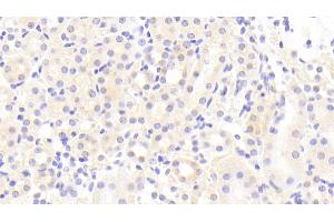 Detection of UCHL1 in Mouse Kidney Tissue using Polyclonal Antibody to Ubiquitin Carboxyl Terminal Hydrolase L1 (UCHL1) (UCHL1 antibody  (AA 2-223))