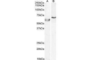 POLL anticorps  (C-Term)