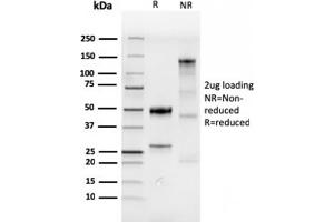 SDS-PAGE Analysis Purified CDX2 Recombinant Rabbit Monoclonal Antibody (CDX2/4394R). (Recombinant CDX2 antibody)