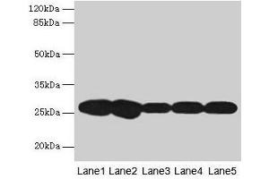 Western blot All lanes: FKBP3 antibody at 4 μg/mL Lane 1: Hela whole cell lysate Lane 2: A431 whole cell lysate Lane 3: PC-3 whole cell lysate Lane 4: Jurkat whole cell lysate Lane 5: 293T whole cell lysate Secondary Goat polyclonal to rabbit IgG at 1/10000 dilution Predicted band size: 26 kDa Observed band size: 26 kDa
