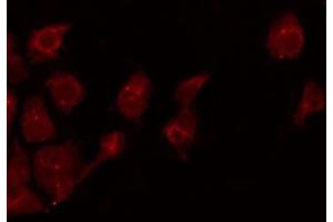 ABIN6275445 staining Hela by IF/ICC. (RAPGEF3 antibody  (C-Term))