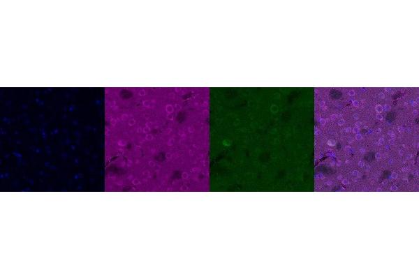 KCNIP2 antibody