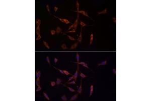 Immunofluorescence analysis of PC-12 cells using MTAP Rabbit mAb (ABIN7268498) at dilution of 1:100 (40x lens). (MTAP antibody)