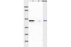 Lane 1: mouse uterus lysates Lane 2: mouse brain lysates probed with Anti PAX2 Polyclonal Antibody, Unconjugated (ABIN738951) at 1:200 in 4 °C. (PAX2A antibody)