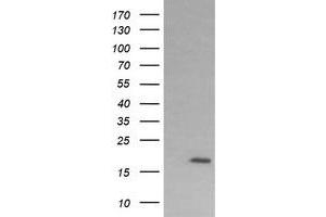 Image no. 2 for anti-Cancer/testis Antigen 1B (CTAG1B) antibody (ABIN1499903) (CTAG1B antibody)