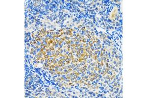 Immunohistochemistry (IHC) image for anti-Sirtuin 2 (SIRT2) (AA 288-389) antibody (ABIN3020852)