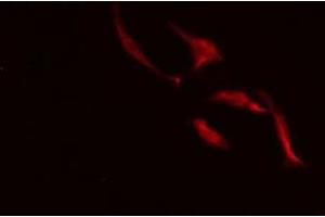 ABIN6275484 staining HeLa cells by IF/ICC. (Repetin antibody  (C-Term))