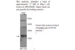 Image no. 1 for anti-BTG Family, Member 2 (BTG2) antibody (ABIN790848)