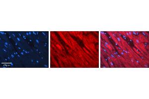 Rabbit Anti-AKT2 Antibody  AV Formalin Fixed Paraffin Embedded Tissue: Human heart Tissue Observed Staining: Cytoplasmic Primary Antibody Concentration: 1:100 Other Working Concentrations: N/A Secondary Antibody: Donkey anti-Rabbit-Cy3 Secondary Antibody Concentration: 1:200 Magnification: 20X Exposure Time: 0.