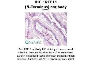 Image no. 1 for anti-Regulator of Telomere Elongation Helicase 1 (RTEL1) antibody (ABIN1738970) (RTEL1 antibody)