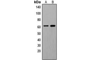 Western blot analysis of SHCA (pY349) expression in HeLa EGF-treated (A), HuvEc EGF-treated (B) whole cell lysates. (SHC1 antibody  (pTyr349))