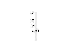 ZNF219 antibody  (C-Term)