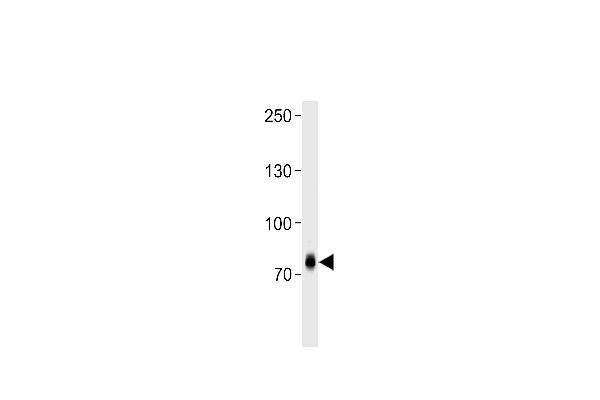 ZNF219 antibody  (C-Term)