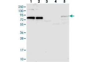Western blot analysis of Lane 1: RT-4, Lane 2: U-251 MG, Lane 3: Human Plasma, Lane 4: Liver, Lane 5: Tonsil with CKAP2L polyclonal antibody  at 1:250-1:500 dilution. (CKAP2L antibody)