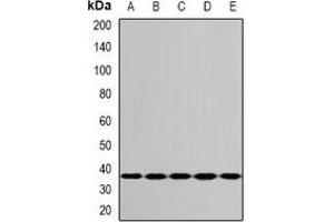 Western blot analysis of RPS3A expression in MCF7 (A), A549 (B), mouse liver (C), mouse lung (D), rat ovary (E) whole cell lysates. (RPS3A antibody)
