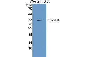 Detection of Recombinant AGC, Cattle using Polyclonal Antibody to Aggrecan (AGC) (Aggrecan antibody  (AA 2066-2316))