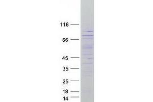 CTD (Carboxy-Terminal Domain, RNA Polymerase II, Polypeptide A) Small Phosphatase Like 2 (CTDSPL2) (C-Term) protein (Myc-DYKDDDDK Tag)