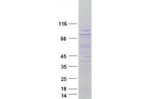 Validation with Western Blot (CTDSPL2 Protein (C-Term) (Myc-DYKDDDDK Tag))