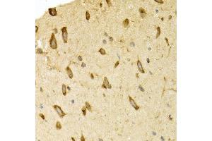 Immunohistochemistry of paraffin-embedded rat brain using APLP1 antibody at dilution of 1:200 (400x lens). (APLP1 antibody)