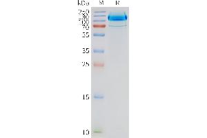 Human -Nanodisc, Flag Tag on SDS-PAGE (GRM2 Protein)