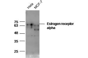 Lane 1: HeLa lysates Lane 2: MCF7 lysates probed with Anti-Estrogen receptor alpha Polyclonal Antibody, Unconjugated  at 1:5000 for 90 min at 37˚C. (Estrogen Receptor alpha antibody  (AA 241-300))