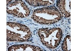 Immunohistochemical staining of paraffin-embedded liver tissue using anti-MCL1 mouse monoclonal antibody. (MCL-1 antibody)