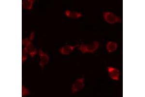 ABIN6273926 staining Hela by IF/ICC. (G Protein-Coupled Receptor 110 antibody  (C-Term))