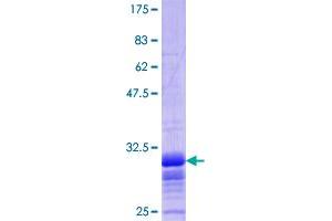 SLC2A2 Protein (AA 32-98) (GST tag)