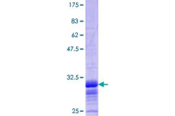 SLC2A2 Protein (AA 32-98) (GST tag)
