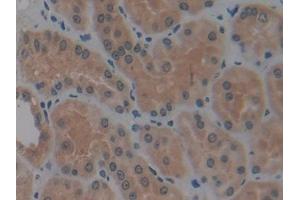 DAB staining on IHC-P; Samples: Human Kidney Tissue (MMP14 antibody  (AA 112-321))