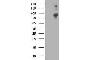 HEK293T cells were transfected with the pCMV6-ENTRY control (Left lane) or pCMV6-ENTRY PDE4B (Right lane) cDNA for 48 hrs and lysed. (PDE4B antibody)